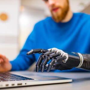 young man working freelance in laptop at home with prosthetic arm